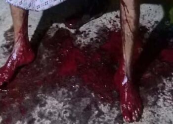 Warga Desa Pada Asal Watuwawer, Antonius Dolu Lerek Ditemukan Berlumuran Darah tak Bernyawa