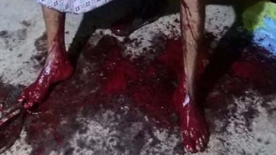 Warga Desa Pada Asal Watuwawer, Antonius Dolu Lerek Ditemukan Berlumuran Darah tak Bernyawa