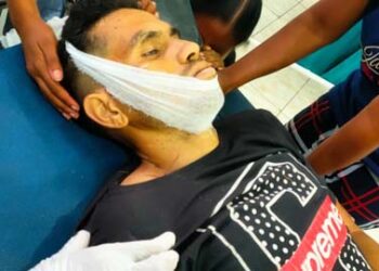 Jatuh dari Pohon, Warga Desa Mahal I – Lembata Tewas Mengenaskan