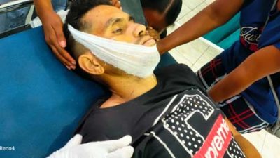 Jatuh dari Pohon, Warga Desa Mahal I – Lembata Tewas Mengenaskan