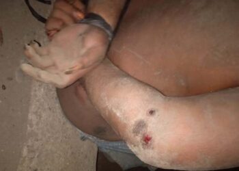 Baru ID Sendiri yang Jadi Tersangka Kasus Pengeroyokan ODGJ di Lembata